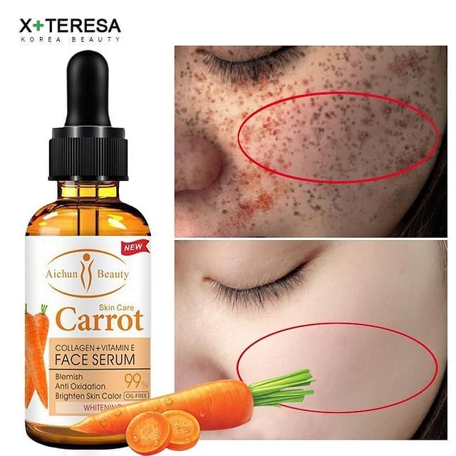 Takeer - CAROT  FACE SERUM Bei 35,000 TU, SIMU /WhatsApp, delivery ipo mikoani tunatuma kwa uaminifu mkubwa tupo external Ubungo (zspy)