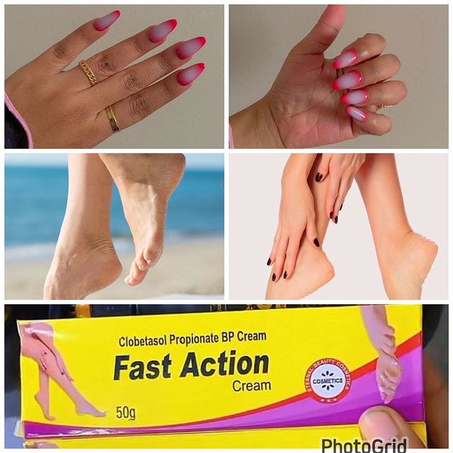 Takeer - Fast action 🔥🔥🔥🔥
📌Hii tube ni kiboko kwenye kutoa sugu mikonon na miguuni, walio itumia wanaijua vizur shughur yake
📌My sister acha kukaa na ...