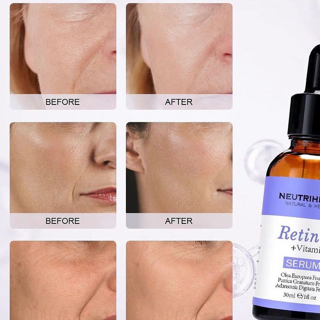 Takeer - Retinol serum ni ant aging nzuri sana hii ni kiboko ya mikunjo machoni ,mashavuni kuzunguka mdomo  inatoa mpaka zile smile line zinazotokeaga ukiwa...